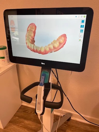 A second view of the 3D dental imaging software used for orthodontic or restorative planning.