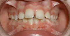 Before