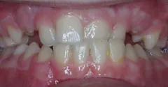 Before